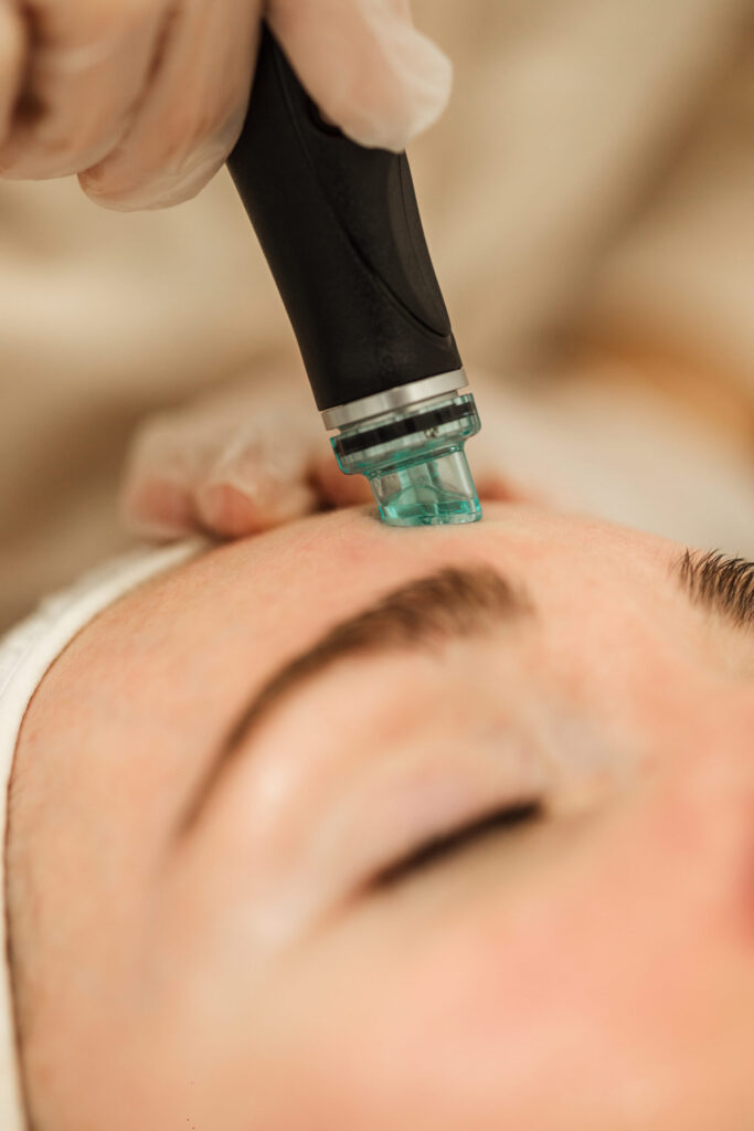 Caucasian woman receiving a Hydrafacial Treatment